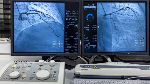 Two monitors displaying results of angiogram sequence working clockwise using x-rays with a contrast agent injected from a tube inserted into the arteries.