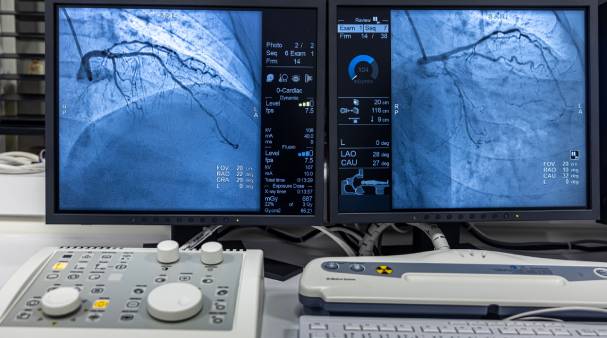 Two monitors displaying results of angiogram sequence working clockwise using x-rays with a contrast agent injected from a tube inserted into the arteries.